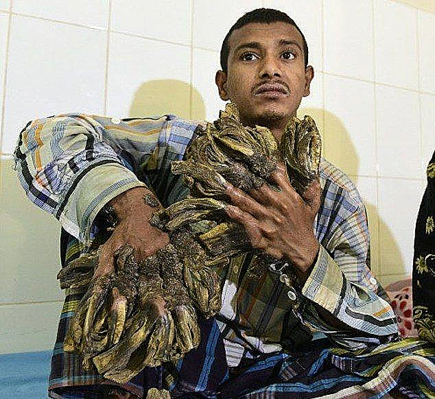 גידולים בצורת ענפים