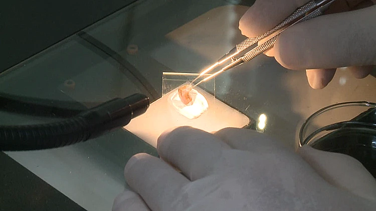 ניתוח ממצאים פורנזים