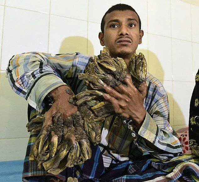 גידולים בצורת ענפים