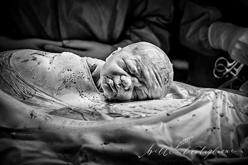 professional-birth-photography-competition-winners-labor-2017-56-58b02c1a68f4e__880