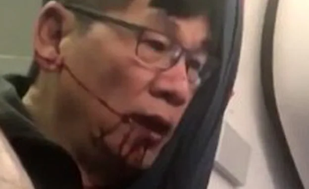 הנוסע שהוכה וטרם זוהה