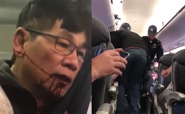 סובל מזעזוע מוח חמור''. דאו