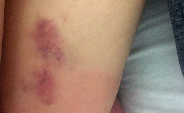 תיעוד ההתעללות