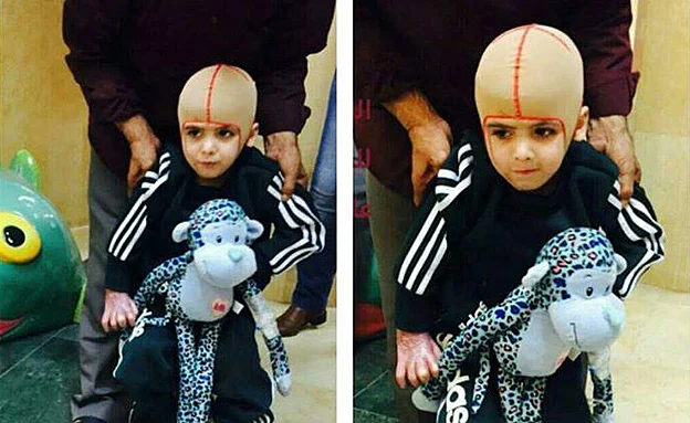 דוואבשה במהלך אשפוזו