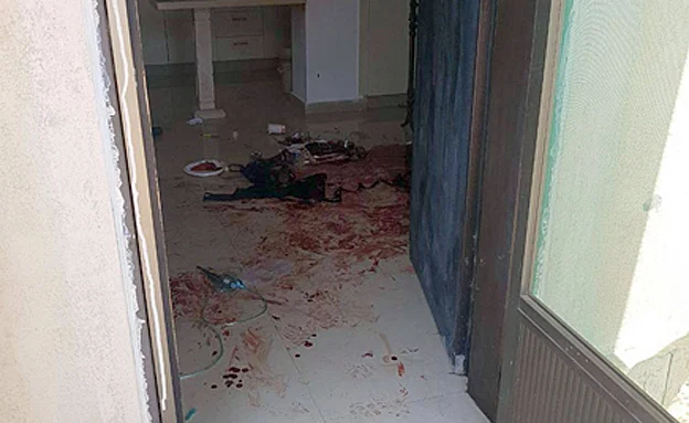 חשד: נפצע במהלך מאבק בפורץ (נתנאל אנגל דוברות מד''א)