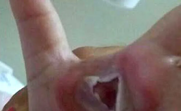 התסמינים החמירו. ''פשוט מזעזע''