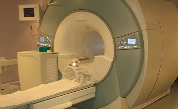 בדיקת MRI ראש נדרשה