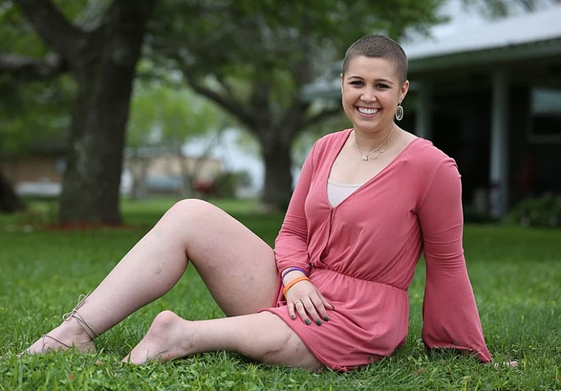 ג'יליאן בגינת ביתה, מציגה את רגלה השמאלית המקוצרת