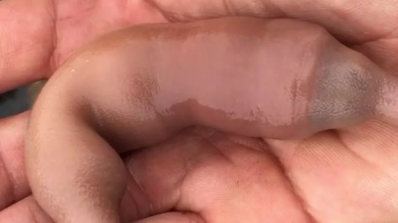 אנחנו לא ממש מעוניינים להיתקל בתולעת הזאת