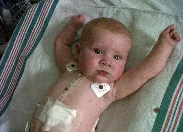 ג'ק לאחר שעבר את הניתוחים