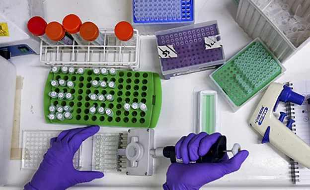 הגולגולת שימשה למטרות לימוד. ארכיון