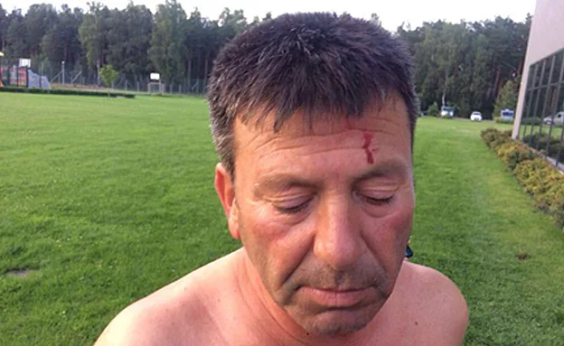 איש המשק שנפצע משה הראל