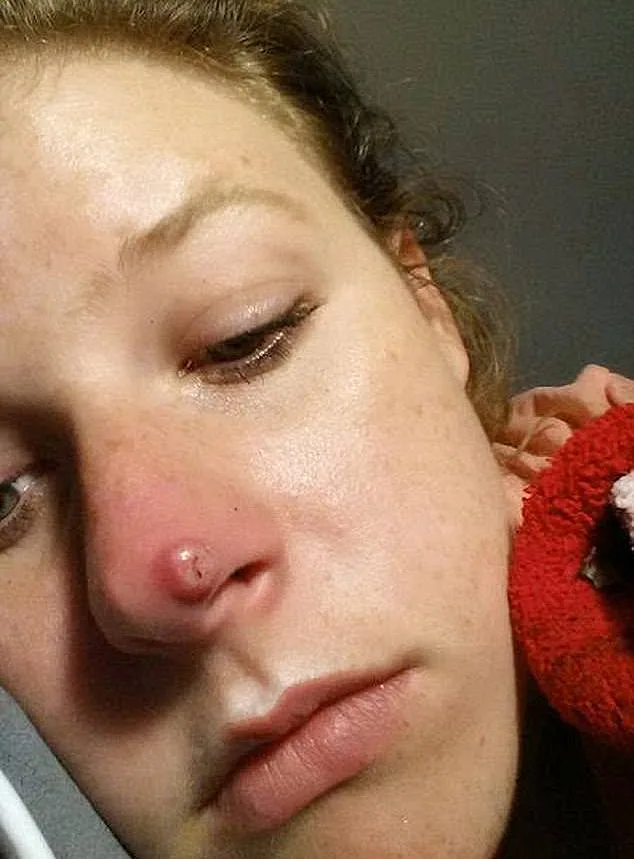 הפצעון שעורר את החשד