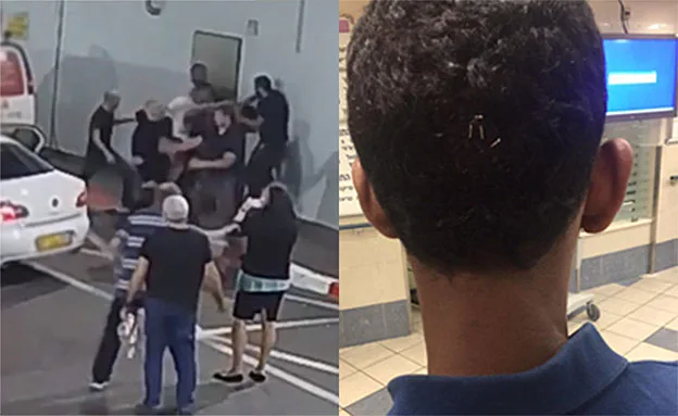 ''שברו לי שיניים''. המאבטח משחזר (דוברות איכילוב)