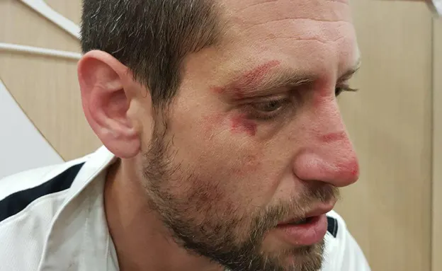 הפיזיותרפיסט שטוען כי הותקף