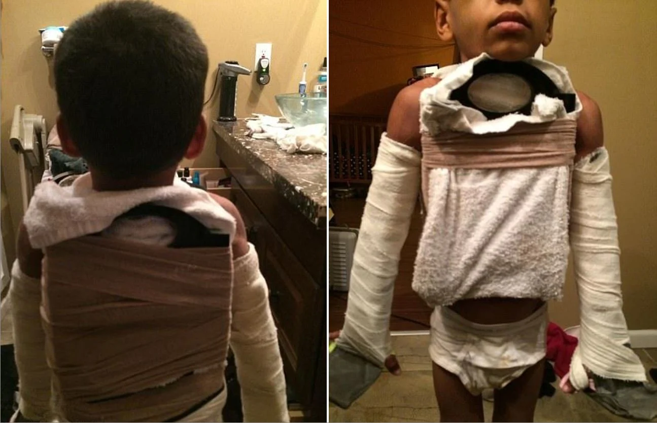 קשרו קרשי חיתו לגבו ובטנו כדי ''ליישר'' את עמידתו