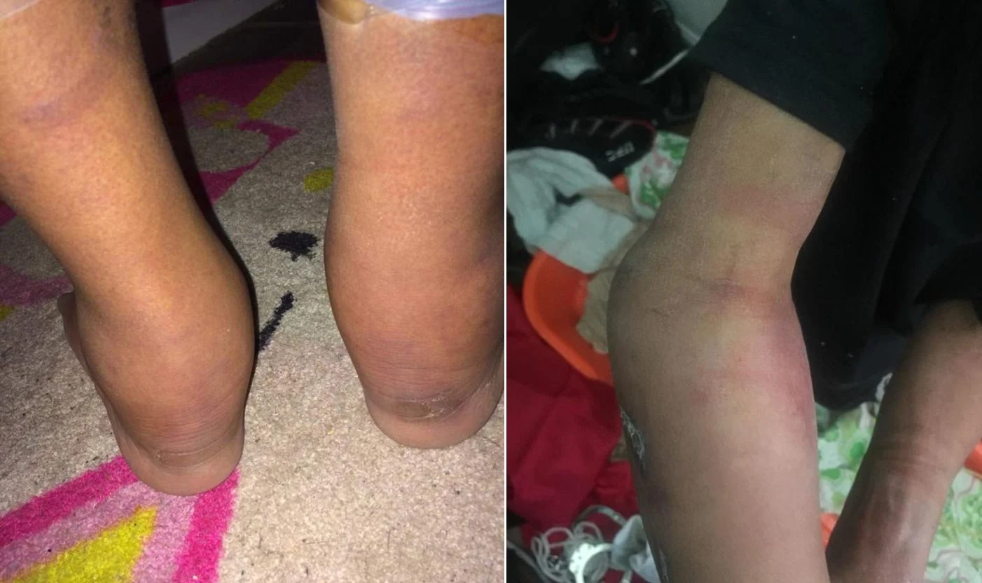 ידיו ורגליו של אדריאן התנפחו מהקשירה, העמידה והמכות