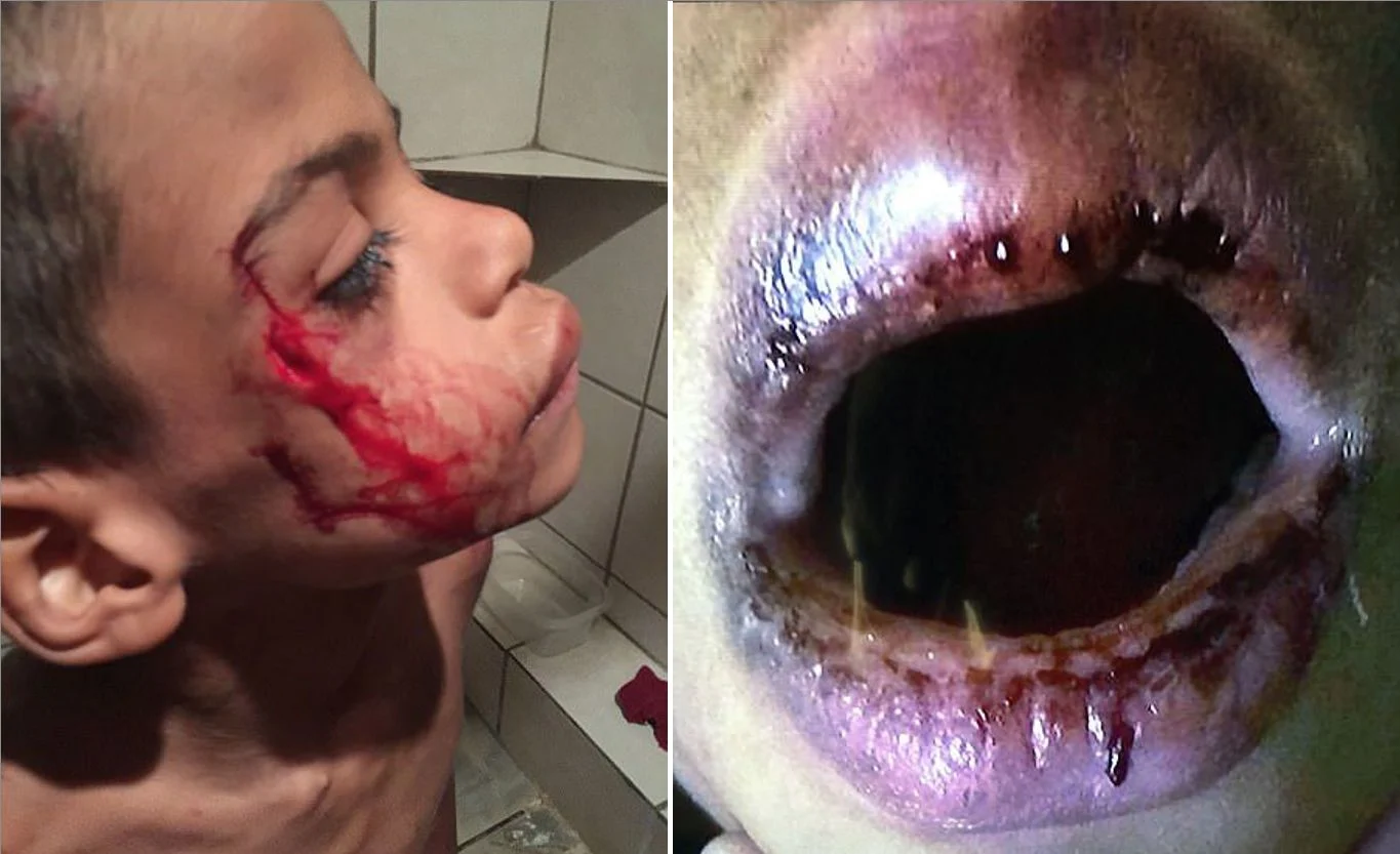 פציעות על פניו (משמאל - לאחר שהוכה במקל, מימין - לאחר שניסה לכרסם את החבל איתו היה קשור)