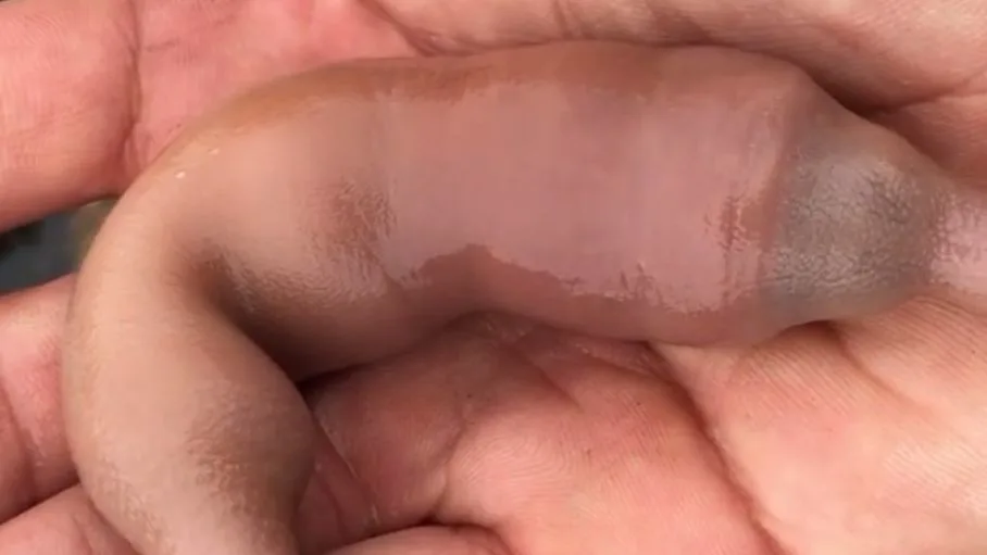 אנחנו לא ממש מעוניינים להיתקל בתולעת הזאת