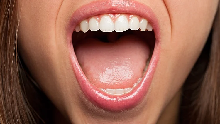 סרטן חלל הפה - תשמרו על הפה שלכם