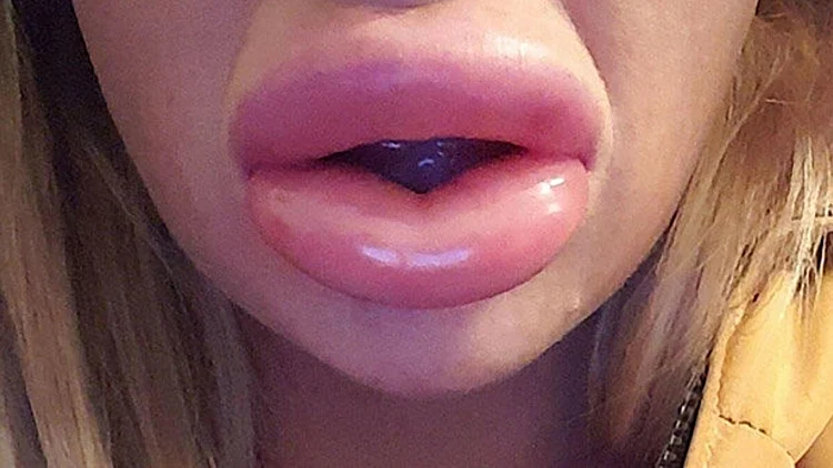 שפתיים