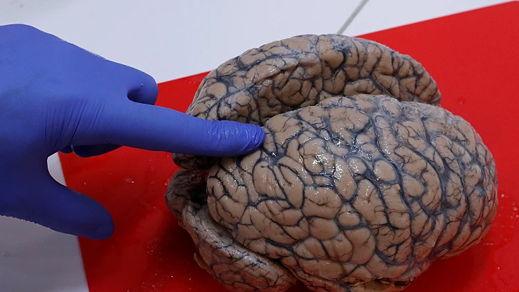חוקר בלגי מצביע על מוח אדם