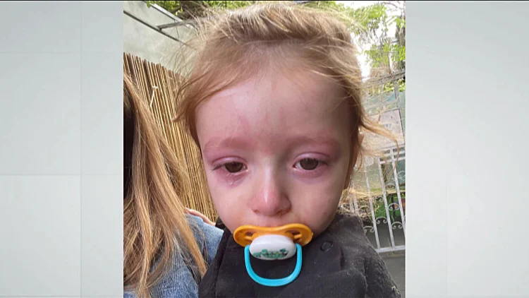 בן השנתיים בילה בג'ימבורי - ונחנק מהתקף אלרגיה: "אין מודעות"