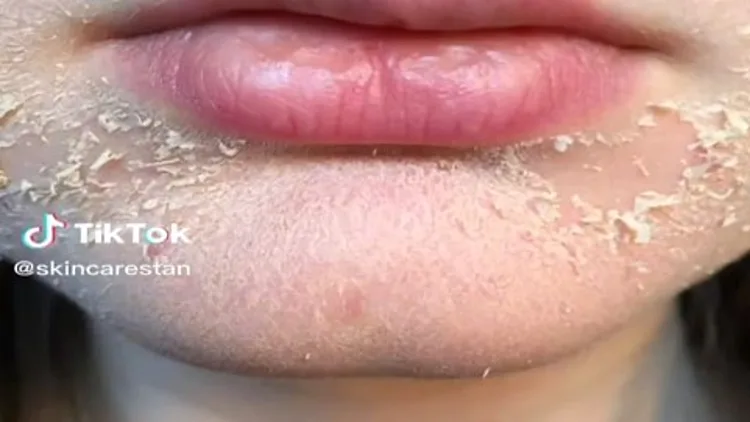 "העור הפך ליבש ופגום": אתגר קרם הפנים המסוכן שמציף את הרשת