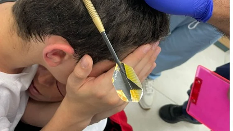 משחק מסוכן: חץ ננעץ בראשו של בן 12 במהלך "קליעה למטרה"