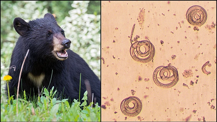 לא נעים: אכלו בשר דוב נא ואושפזו עם תולעת טפילית במוח