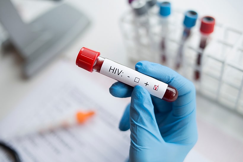 בדיקת חיובית של נגיף הHIV