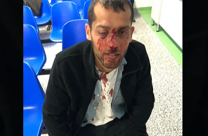 אחד הסטודנטים שהותקף בפולין