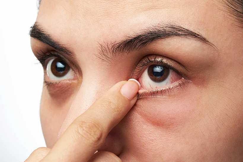 אבחון מדוייק על ידי רופא עיניים