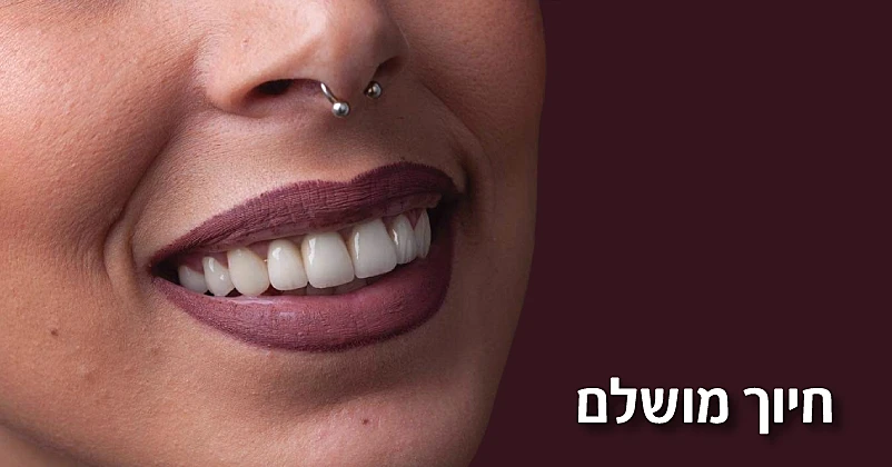 השתלות שיניים איכותיות