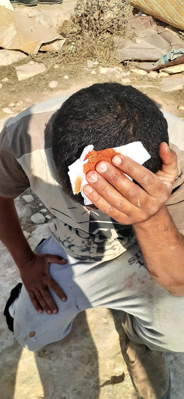 פלסטיני שנפצע באירועי האלימות בדרום הר חברון