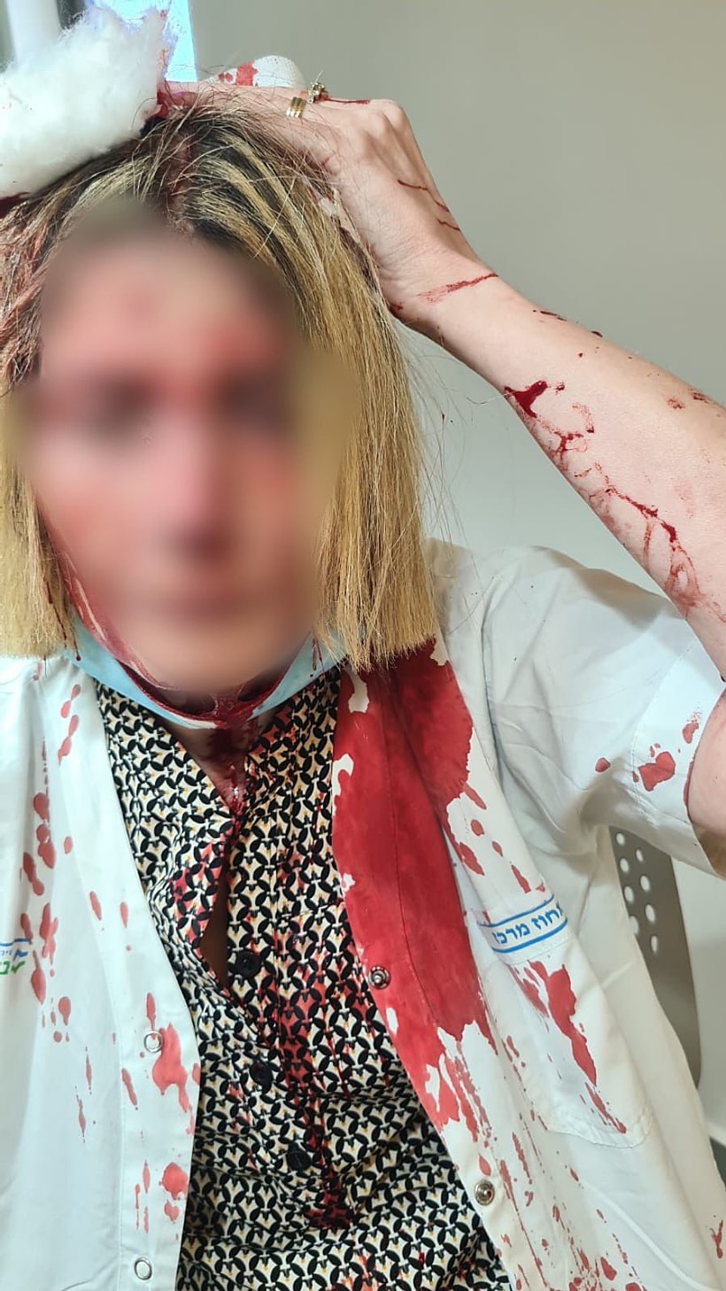 הרופאה שהותקפה בקופת החולים בבאר יעקב