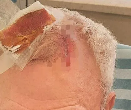 הגבר בן ה-73 שנפצע בתקיפה