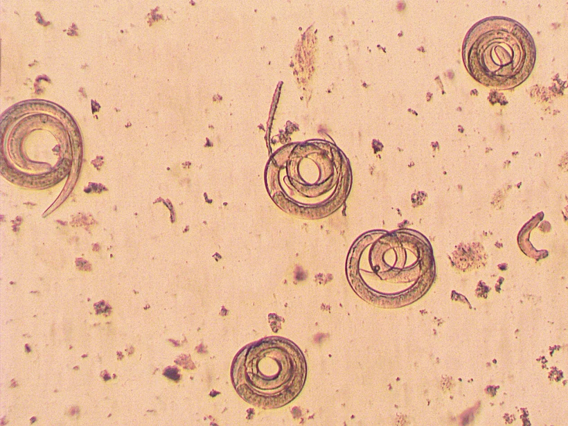 Trichinella,spiralis, ,parasitic,worm,microscope