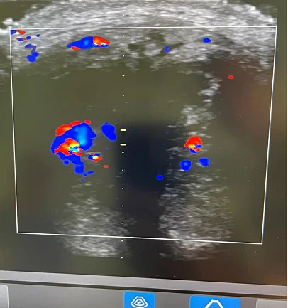 Doppler Signal Of The Corpora