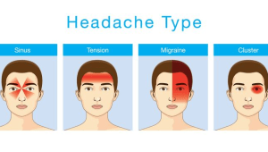 איך מטפלים ב-5 סוגי כאבי ראש?