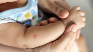 כך תגנו על תינוקכם מפני עקיצות יתושים