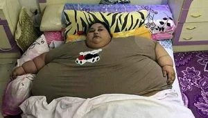 נפטרה האישה השמנה בעולם
