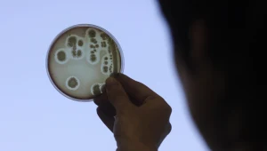 הסכנה השקטה: חיידקים מזהמים נמצאים בכל מקום בו אנו נוגעים