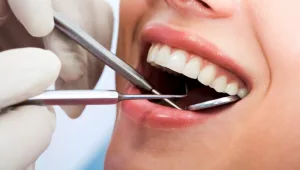 נבחרת הצדיקים של הכול כלול - טיפול שיניים בחינם