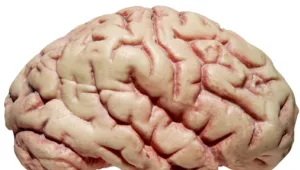חיים בריא: אבחון אוטמים במוח