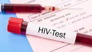 חיים בריא: מי בקבוצת הסיכון לחלות באיידס?