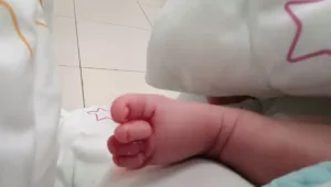 "הוא היה יכול לאבד את הבוהן": מה עושים כששיערה נכרכת סביב האצבע של התינוק?