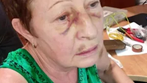 קשישה הותקפה בביתה: "השכן עלה ותקף באלימות קשה"