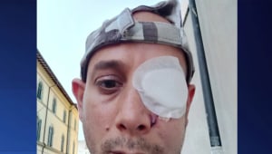 תקיפה אנטישמית באיטליה: צעיר ישראלי הוכה בחנות מזכרות
