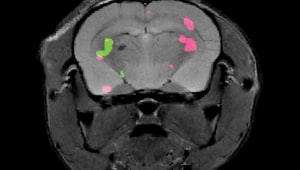 שיטת "הזרקת" הצבע לסריקות MRI: האם בקרוב ניתן יהיה לנטר תאים סרטניים בגוף?